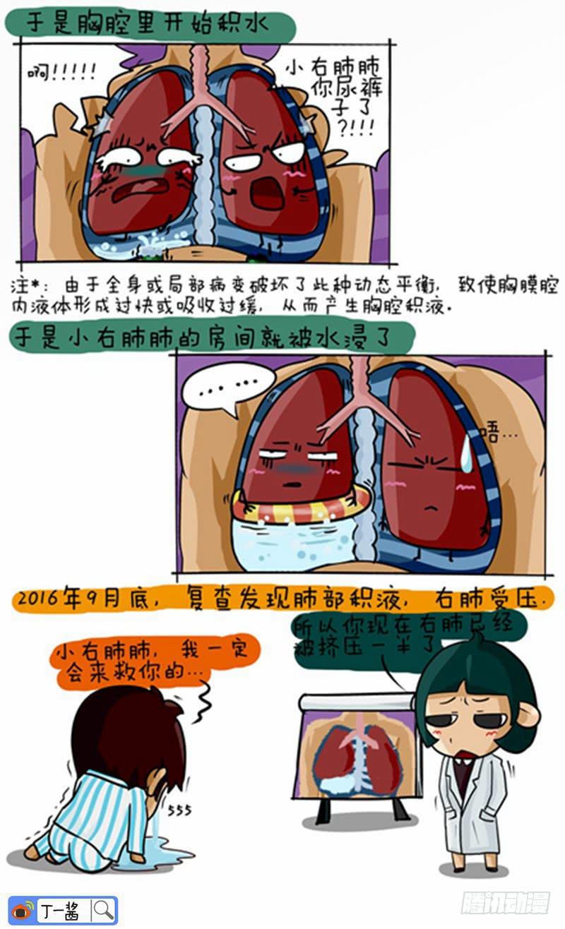 第46话 胸腔积水-第47话