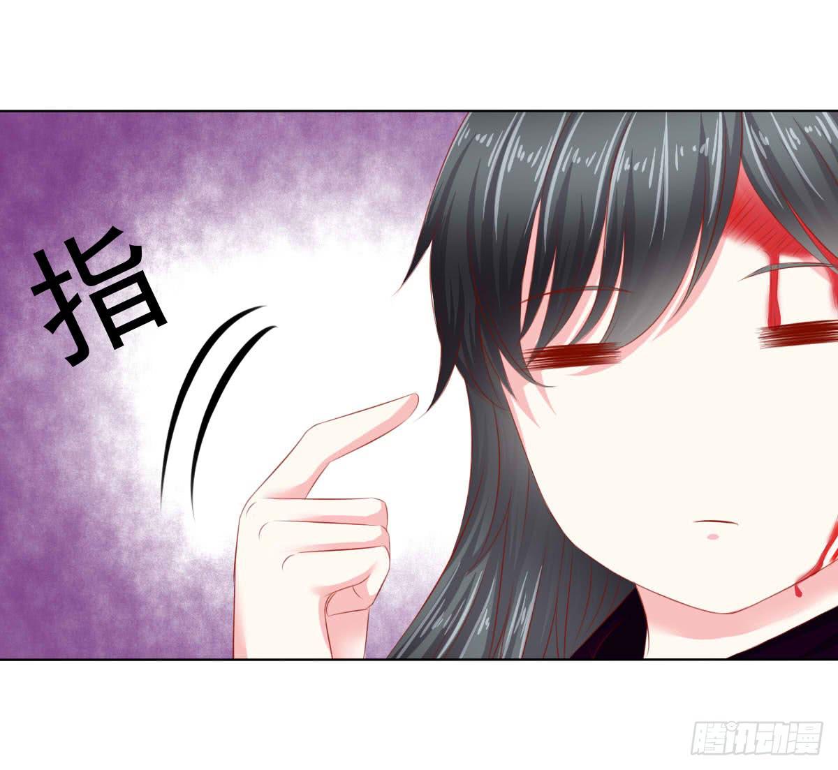 受伤-第105话