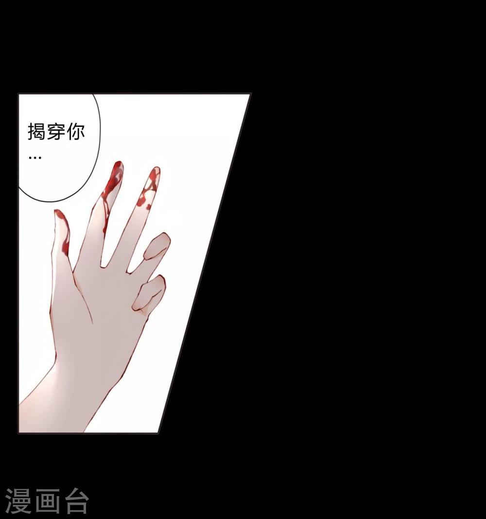 第21话 手断了？-第21话