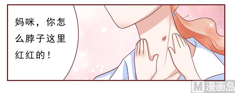 第181话 脖子这里红红的-第183话