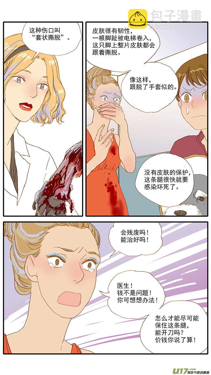 115 袖套状撕脱（管形皮瓣术）-第115话
