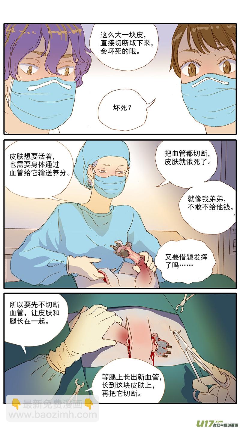 115 袖套状撕脱（管形皮瓣术）-第115话