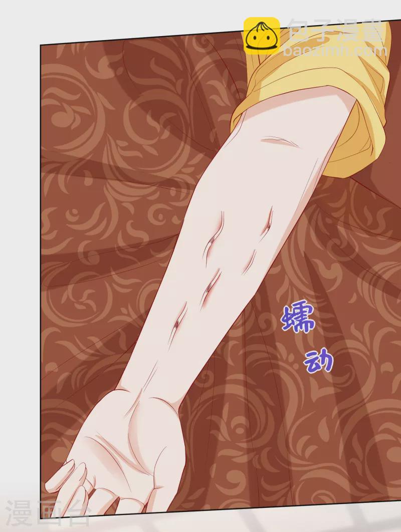 🍼毒医嫡女 第231话 顾七月用针如神 第28页