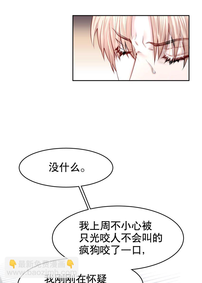 第33章 疯狗咬了一口-第41话