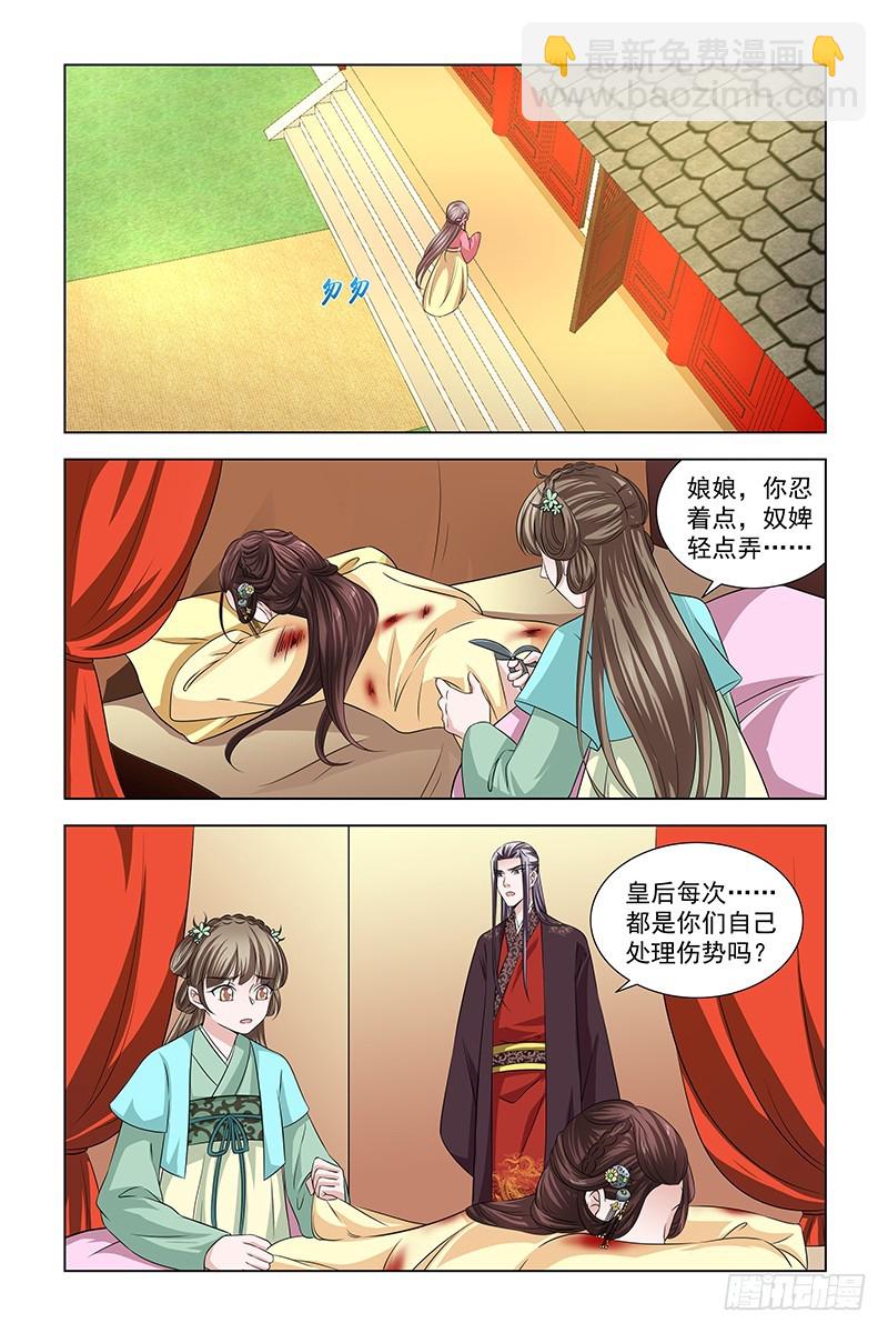 050 快给皇后医治-第51话