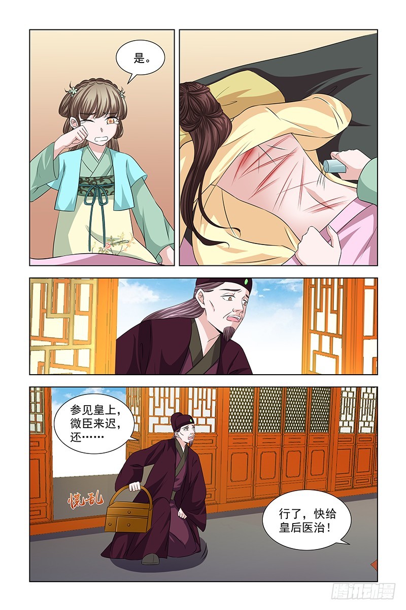 050 快给皇后医治-第51话