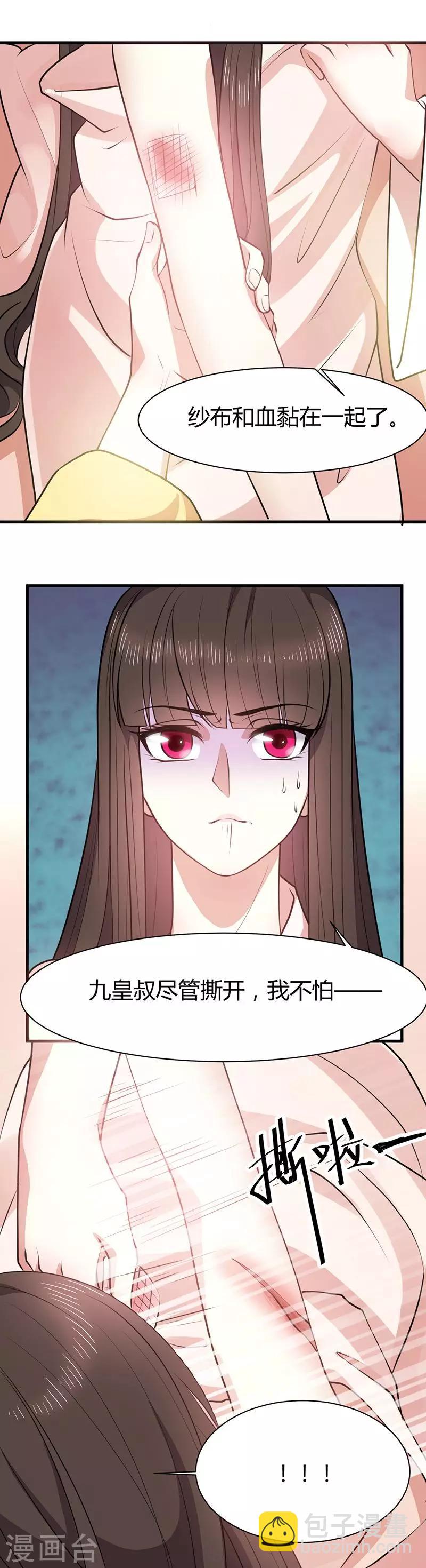 第15话 舍不得本王的吻？-第15话