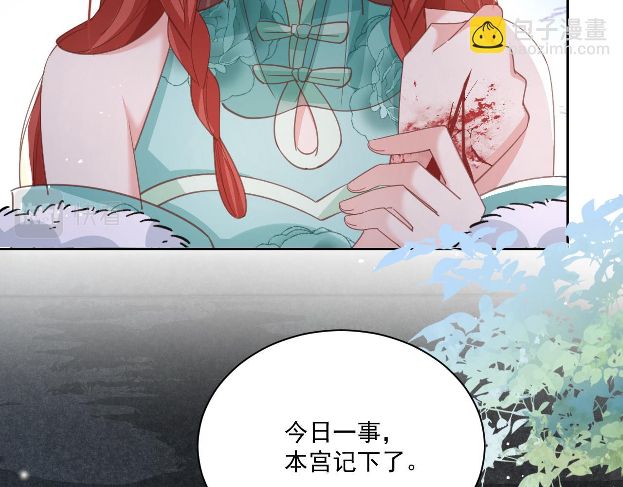 第77话 兔子被怀疑(1/2)-第79话