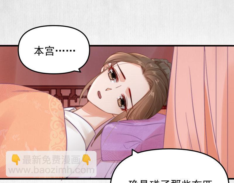 第56话 苏绯色你难逃干系(1/2)-第57话
