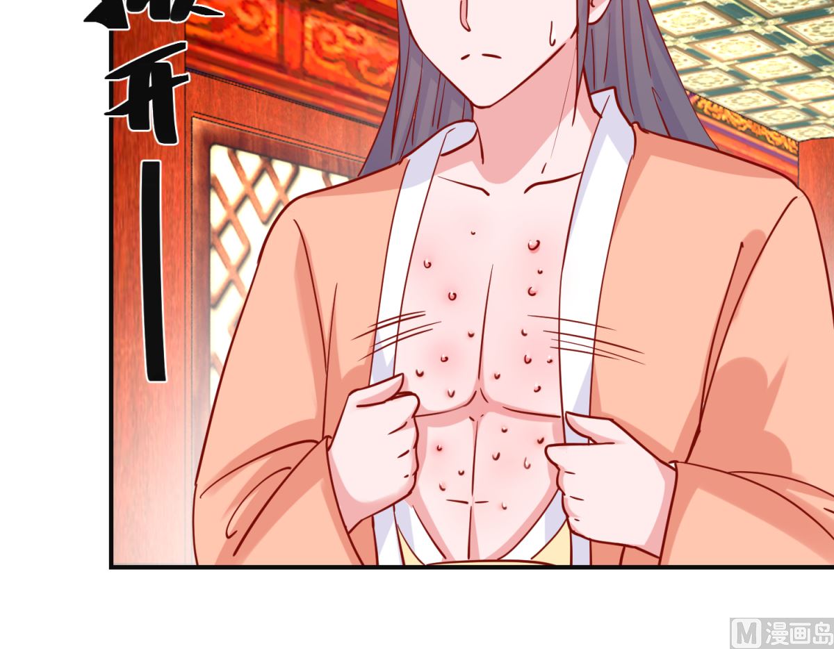 第94话 佗妃的隐疾-第95话
