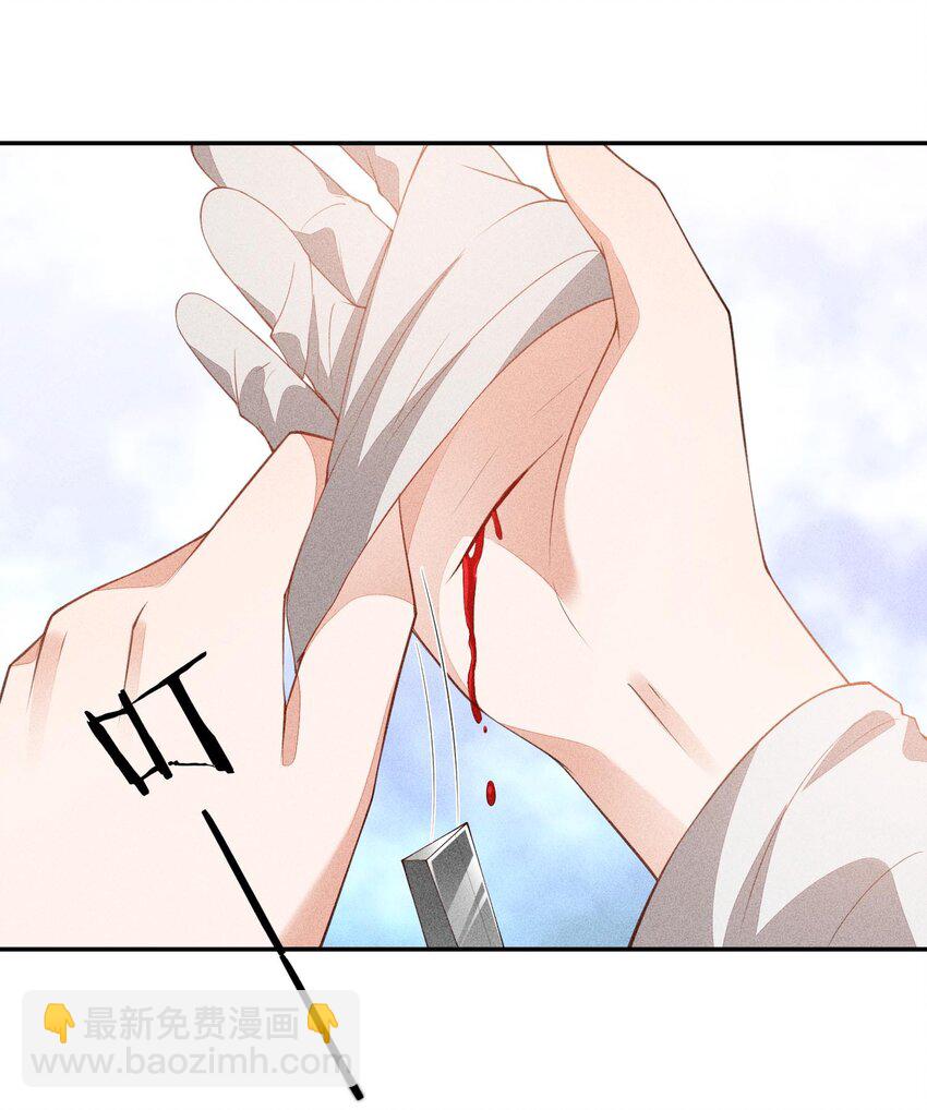 085 手套里的阴谋(1/2)-第87话