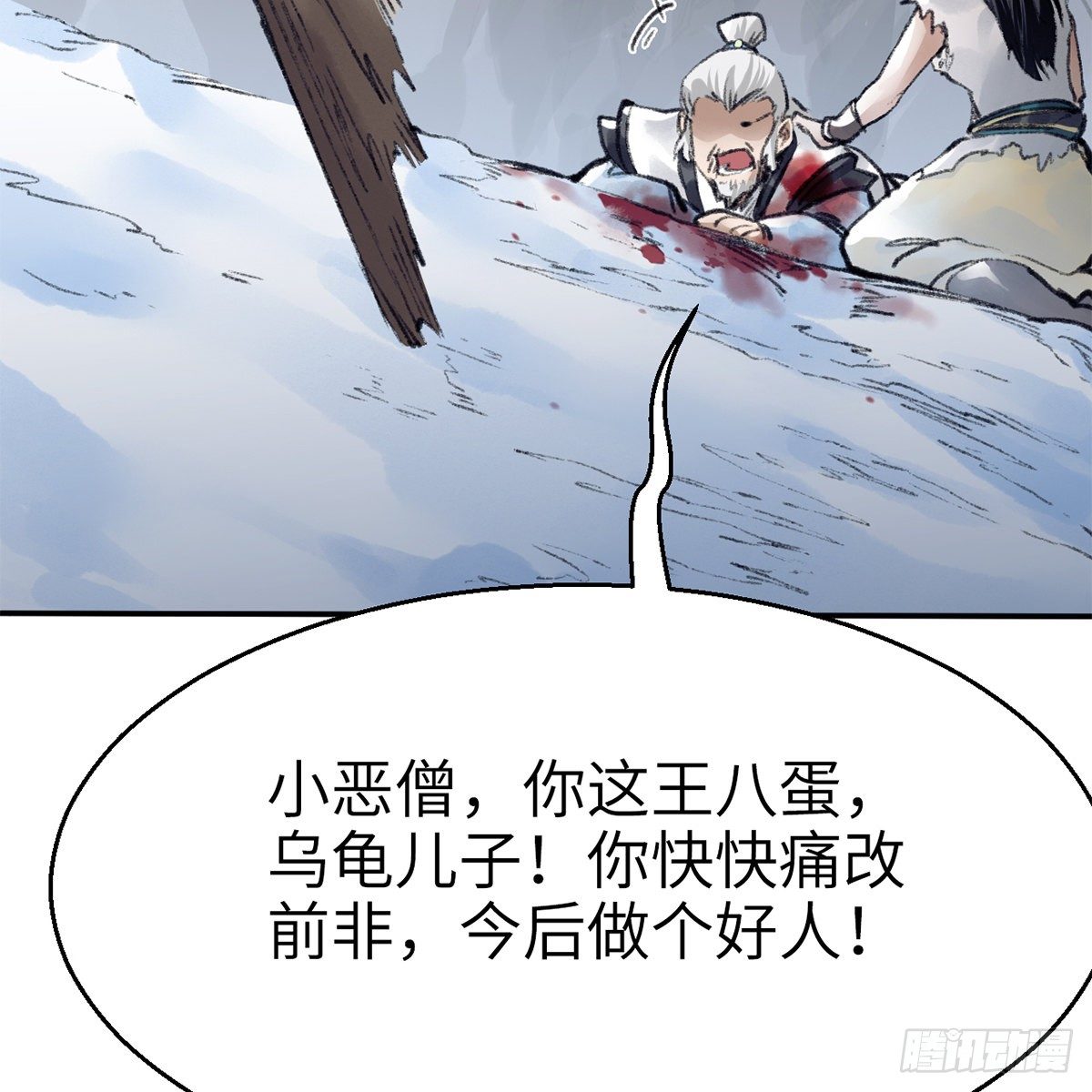 第五十二话 断腿之厄(1/2)-第53话