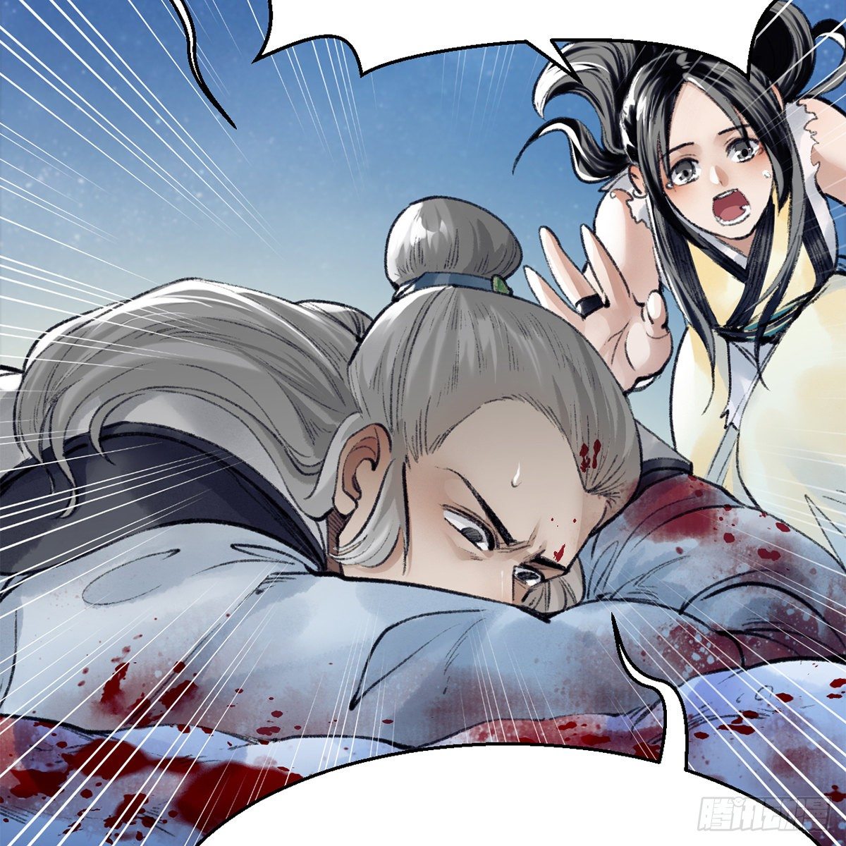 第五十二话 断腿之厄(1/2)-第53话