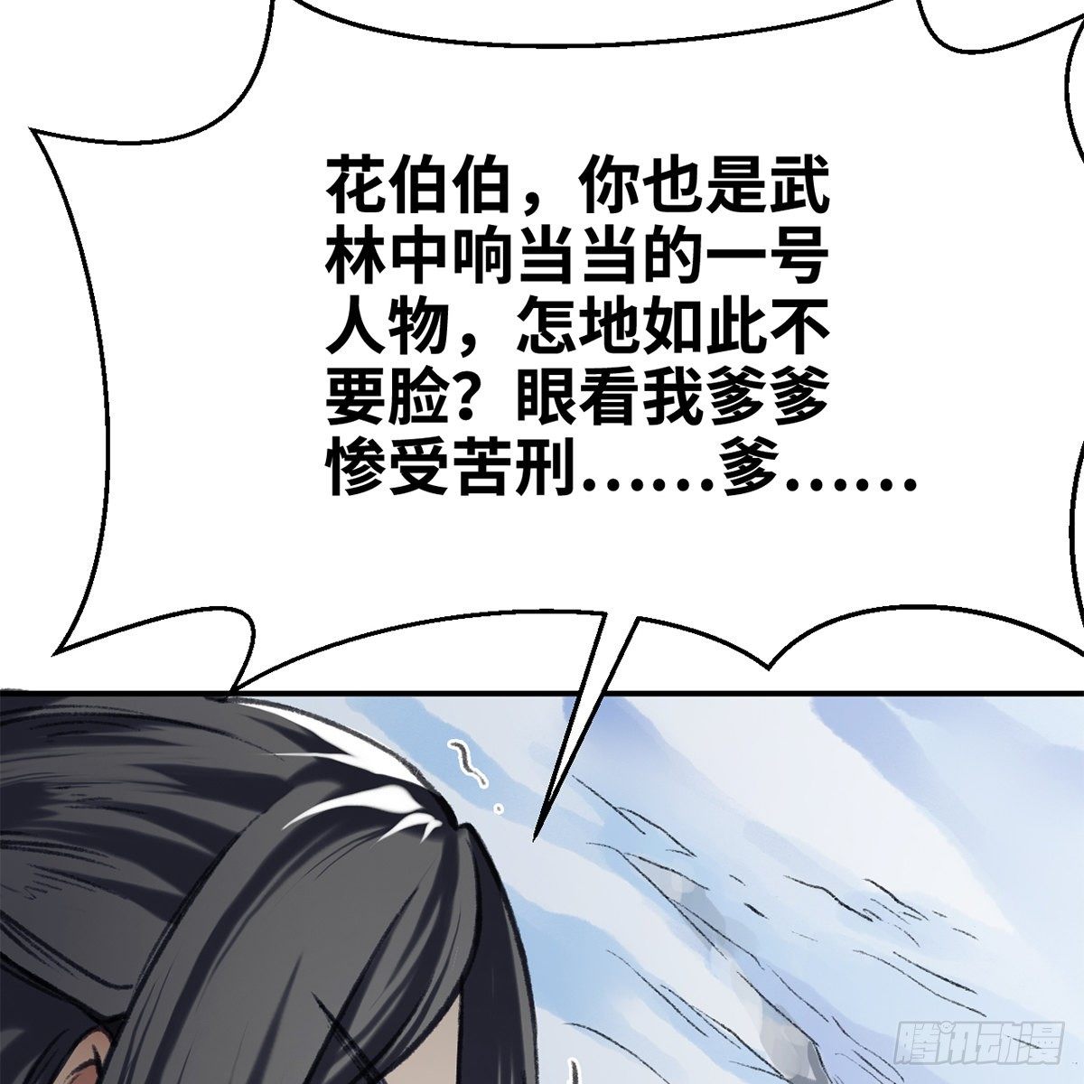 第五十二话 断腿之厄(1/2)-第53话