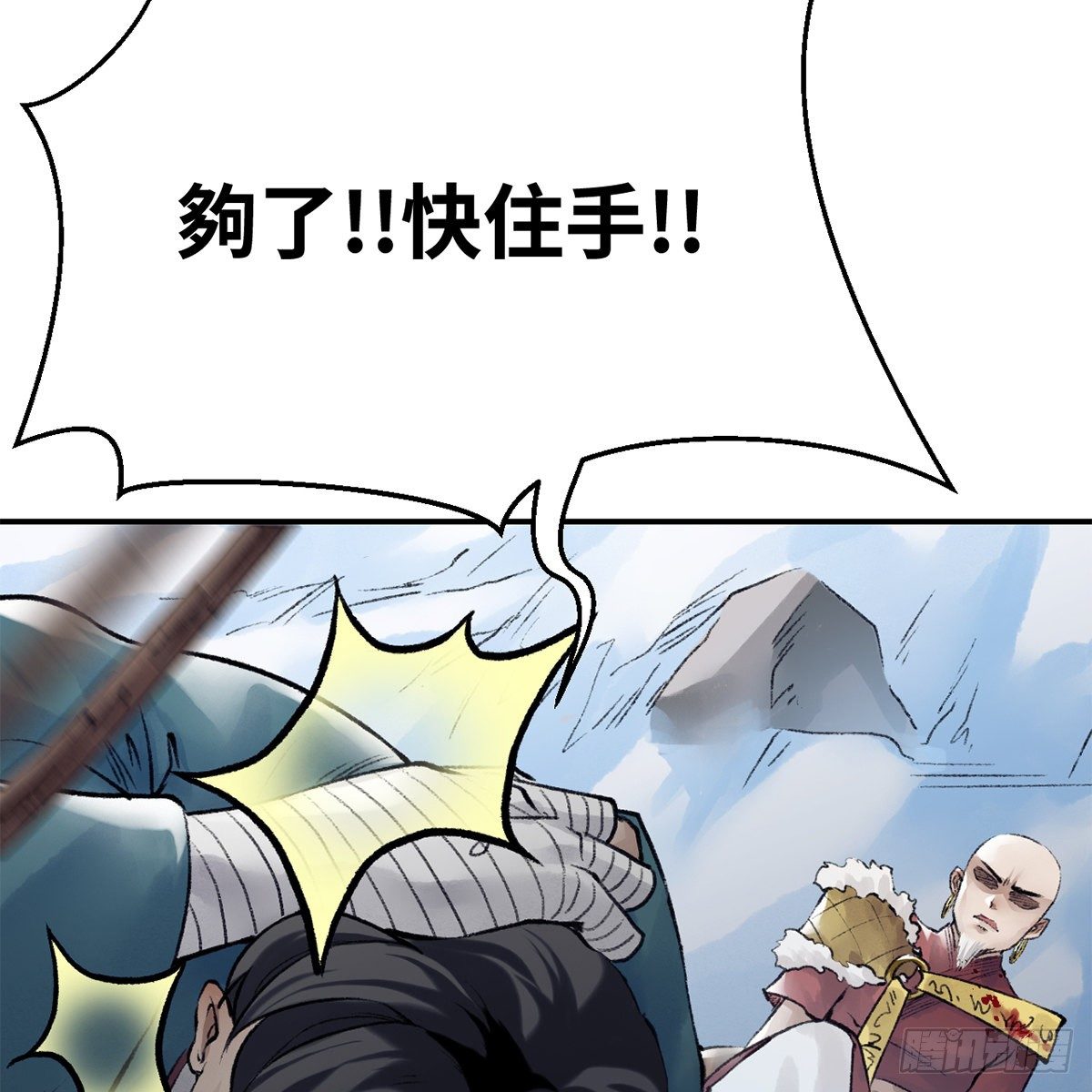 第五十二话 断腿之厄(1/2)-第53话
