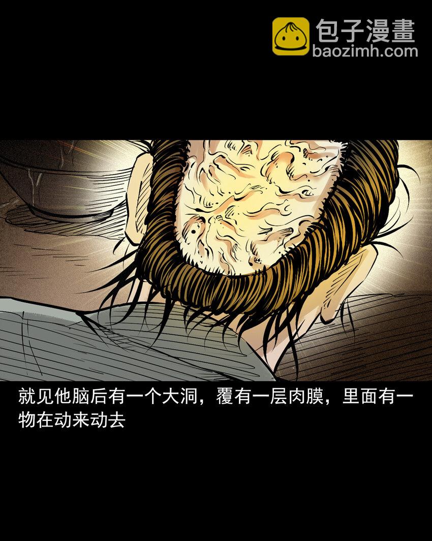 109 第109话牛瘟-第109话