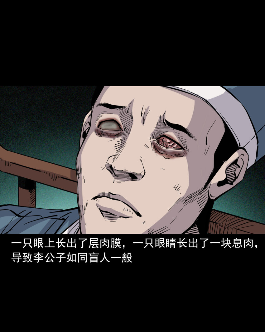 113 第113话双瞳-第113话