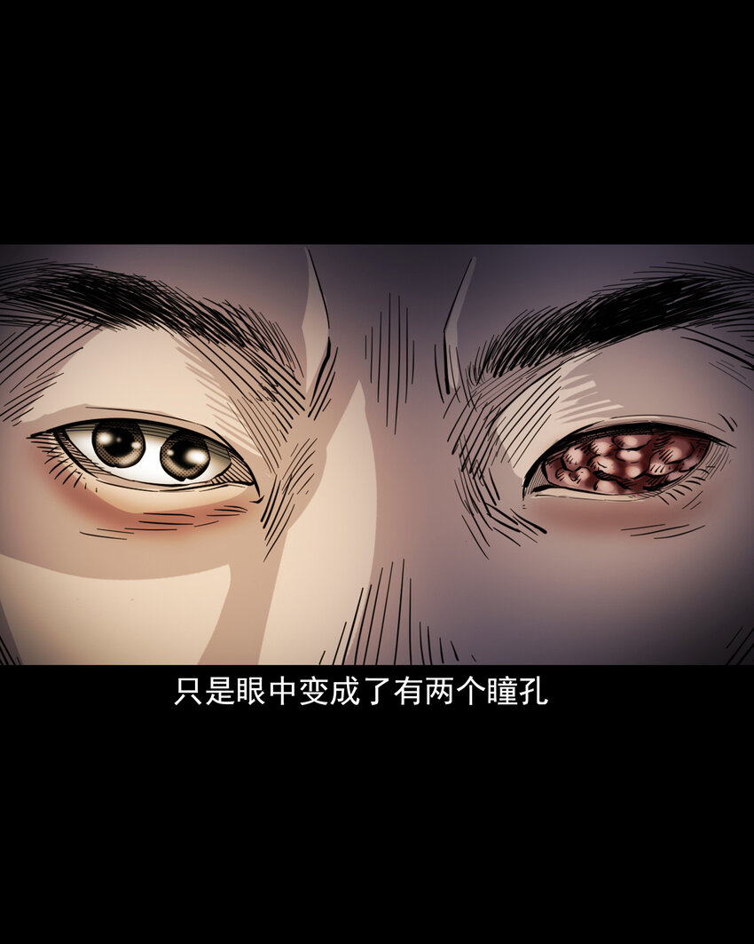 113 第113话双瞳-第113话