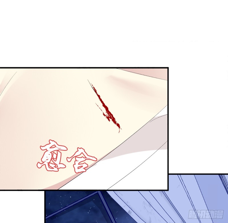 让我咬你一口吧!(1/2)-第329话