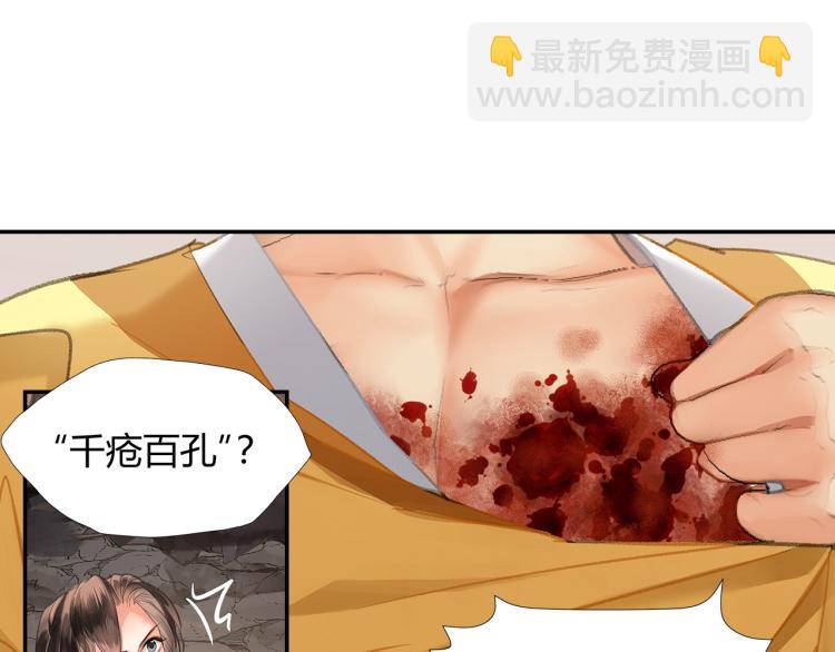 第204话 千疮百孔咒(1/2)-第207话
