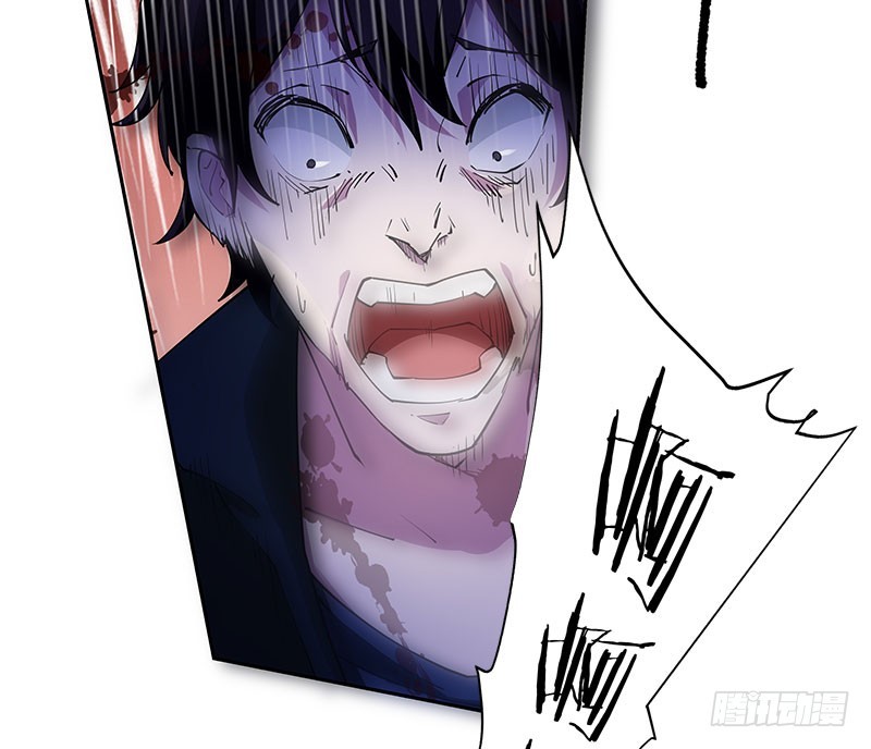 被袭！疯狂的人头狗-第51话