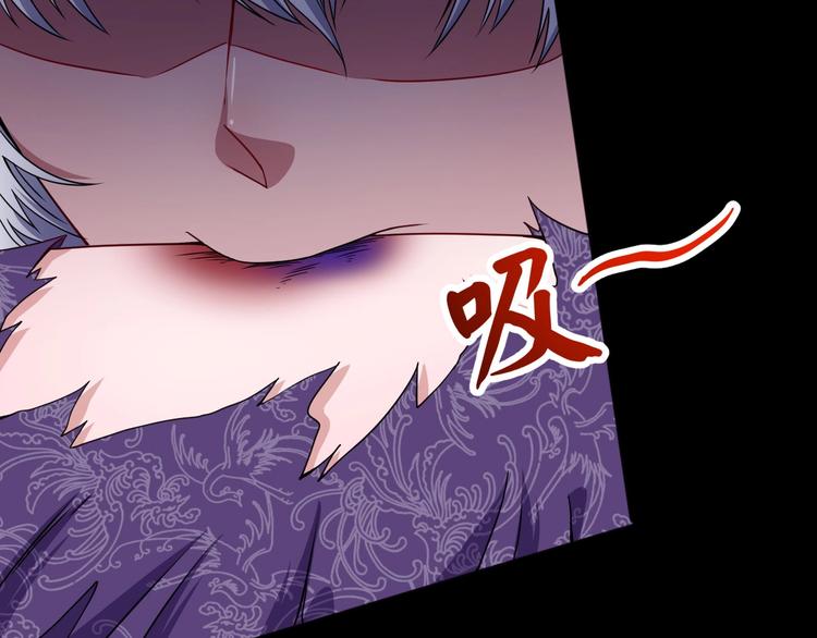 第75话 狂化的小白(1/3)-第79话