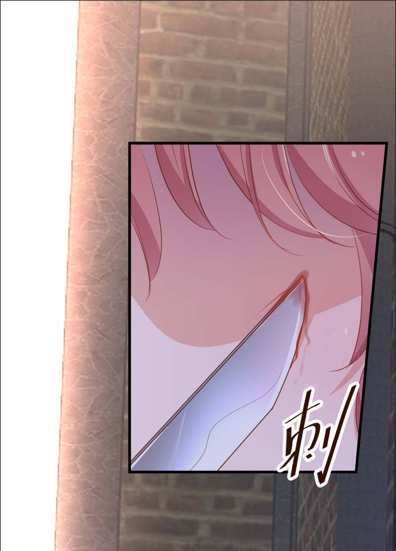 第87话 受到伤害-第93话