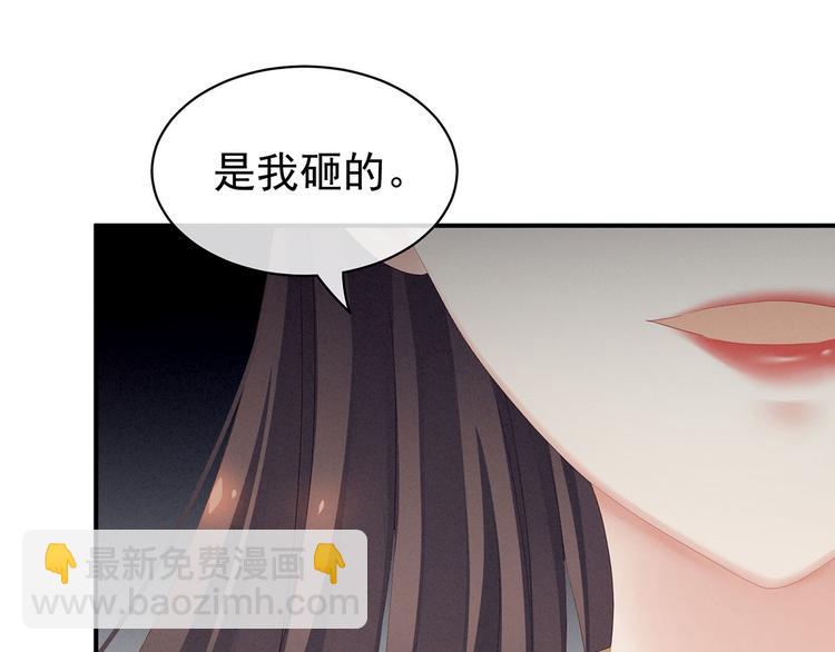 第115话 疼吗？(1/3)-第121话