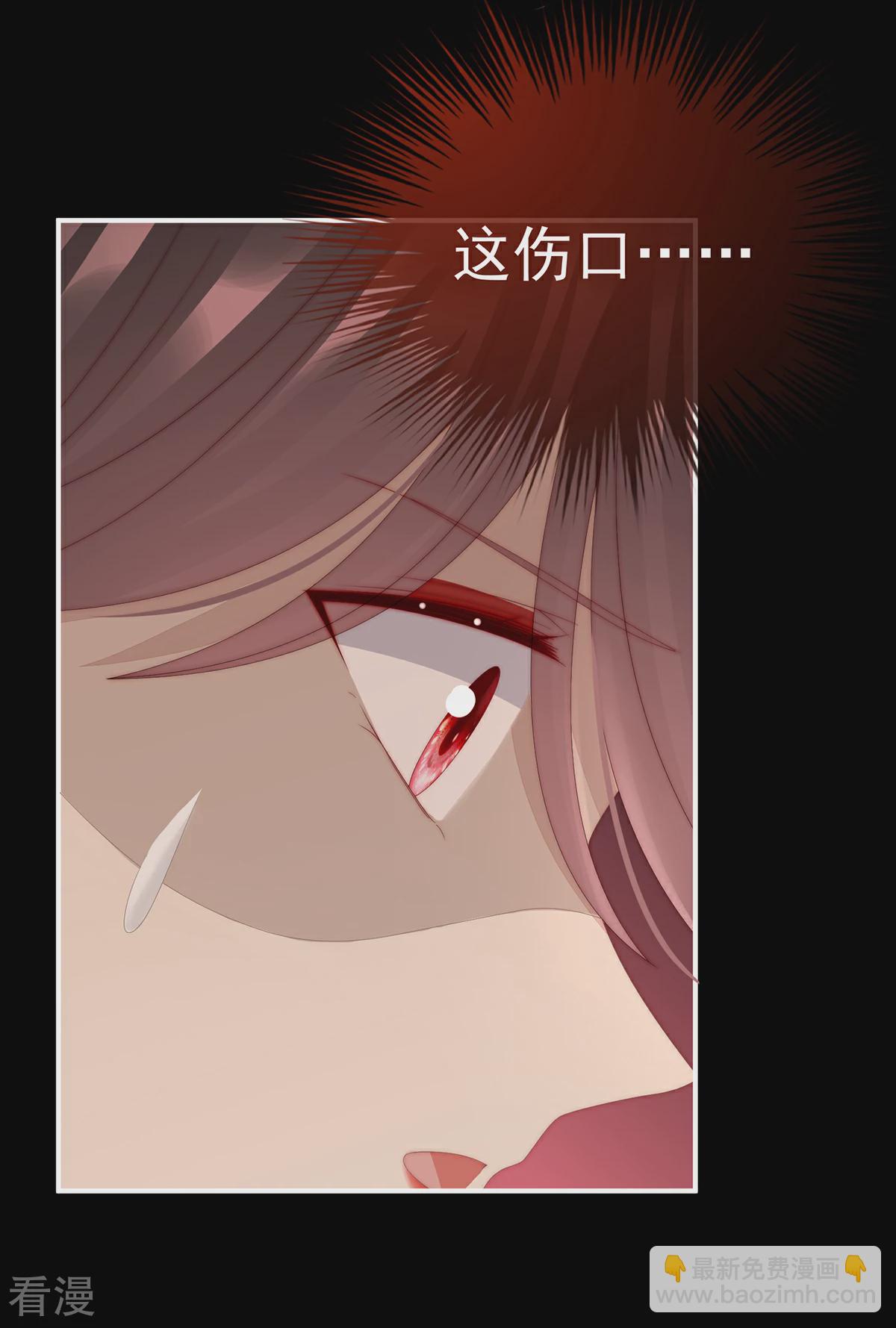 第63话 小猪仔要死了？！-第67话
