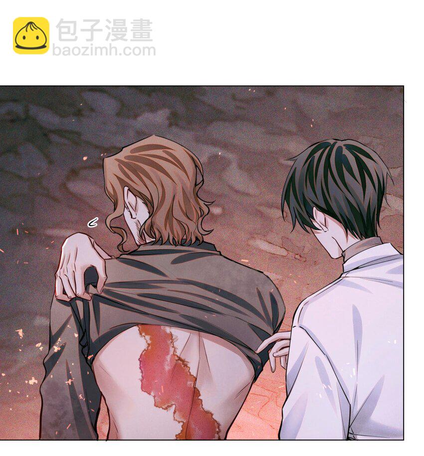 78 奇怪的伤口-第79话