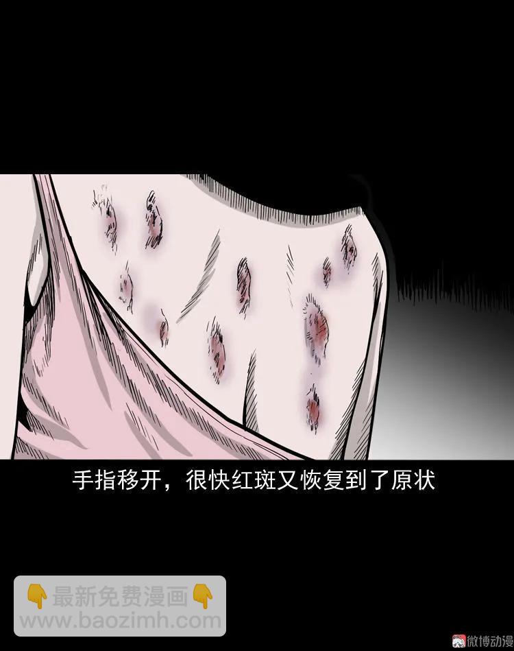 尸斑(1/2)-第113话