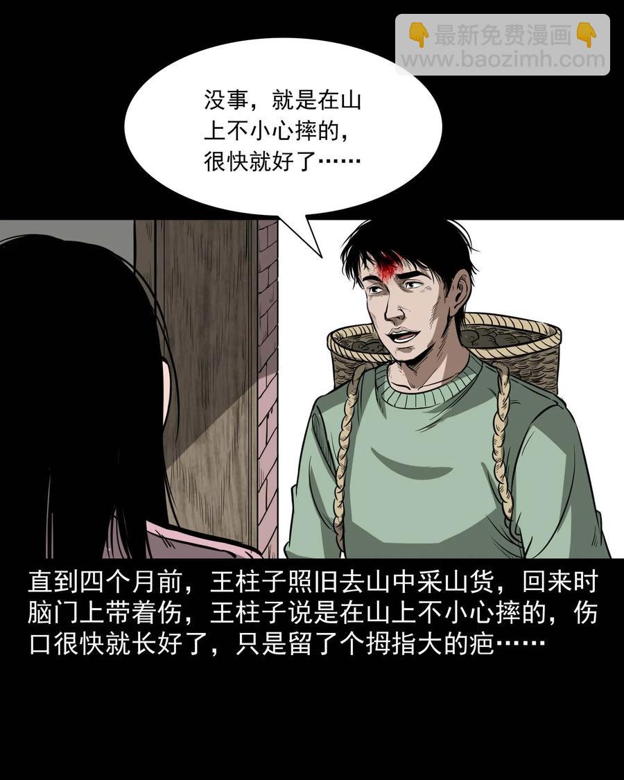 313 疯病(1/2)-第315话