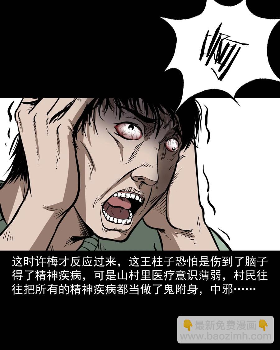 313 疯病(1/2)-第315话