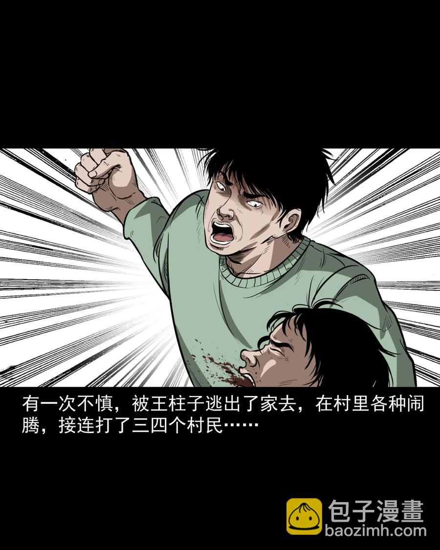 313 疯病(1/2)-第315话