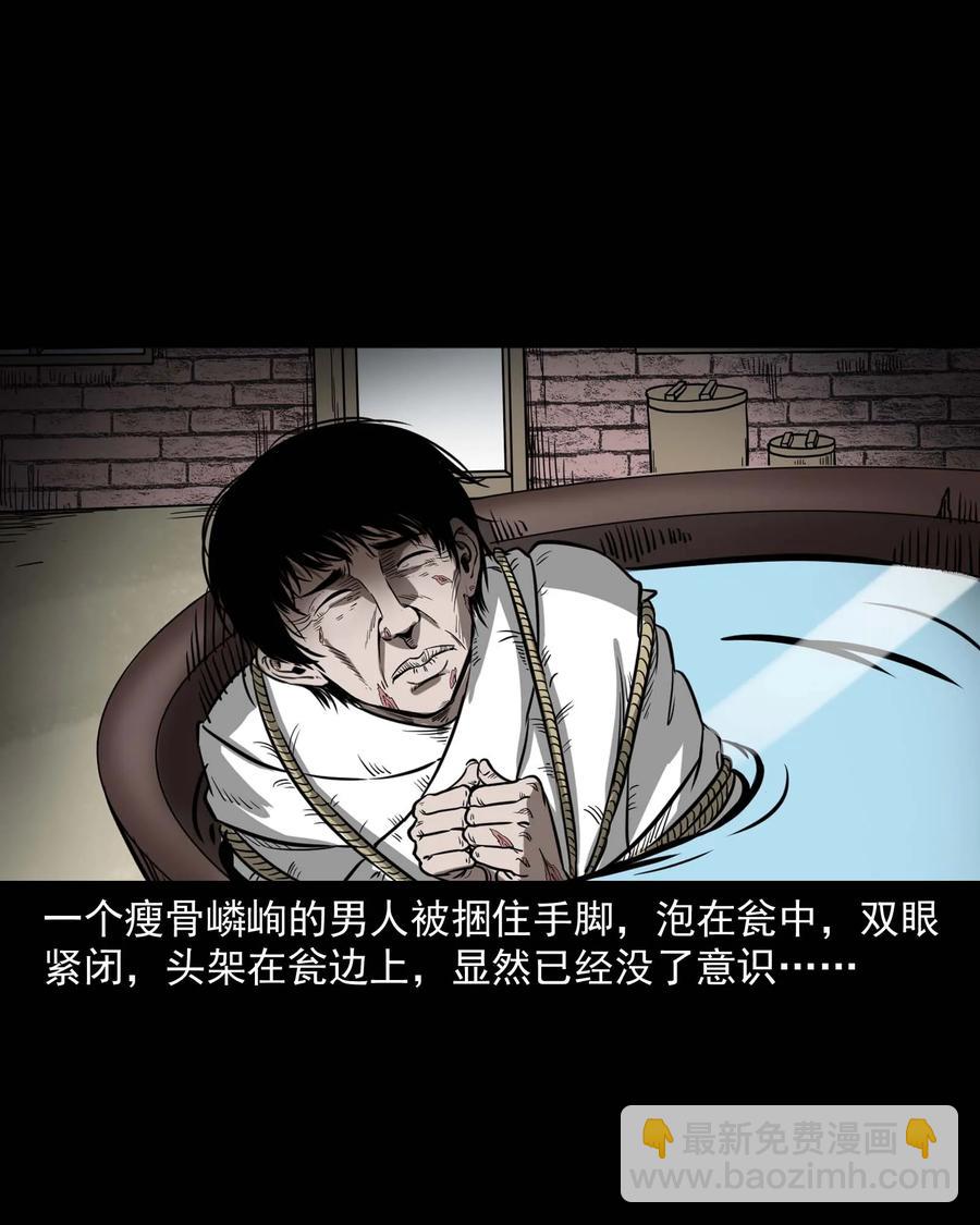 313 疯病(1/2)-第315话