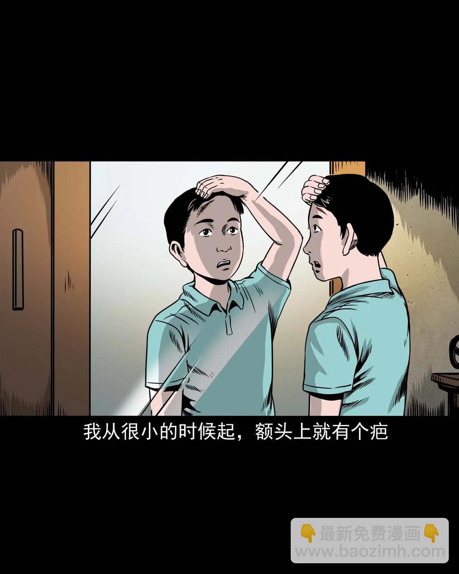 335 额头上的疤(1/2)-第337话
