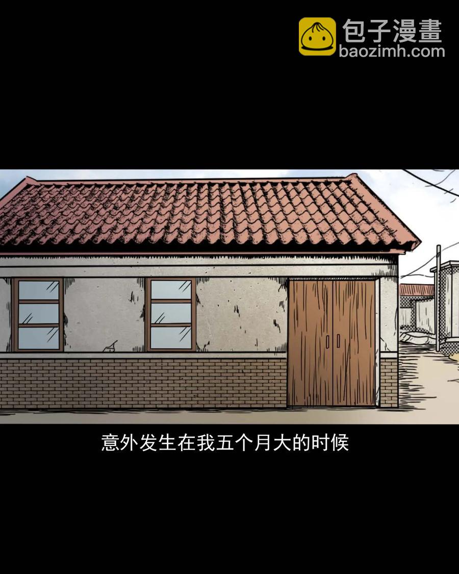 335 额头上的疤(1/2)-第337话