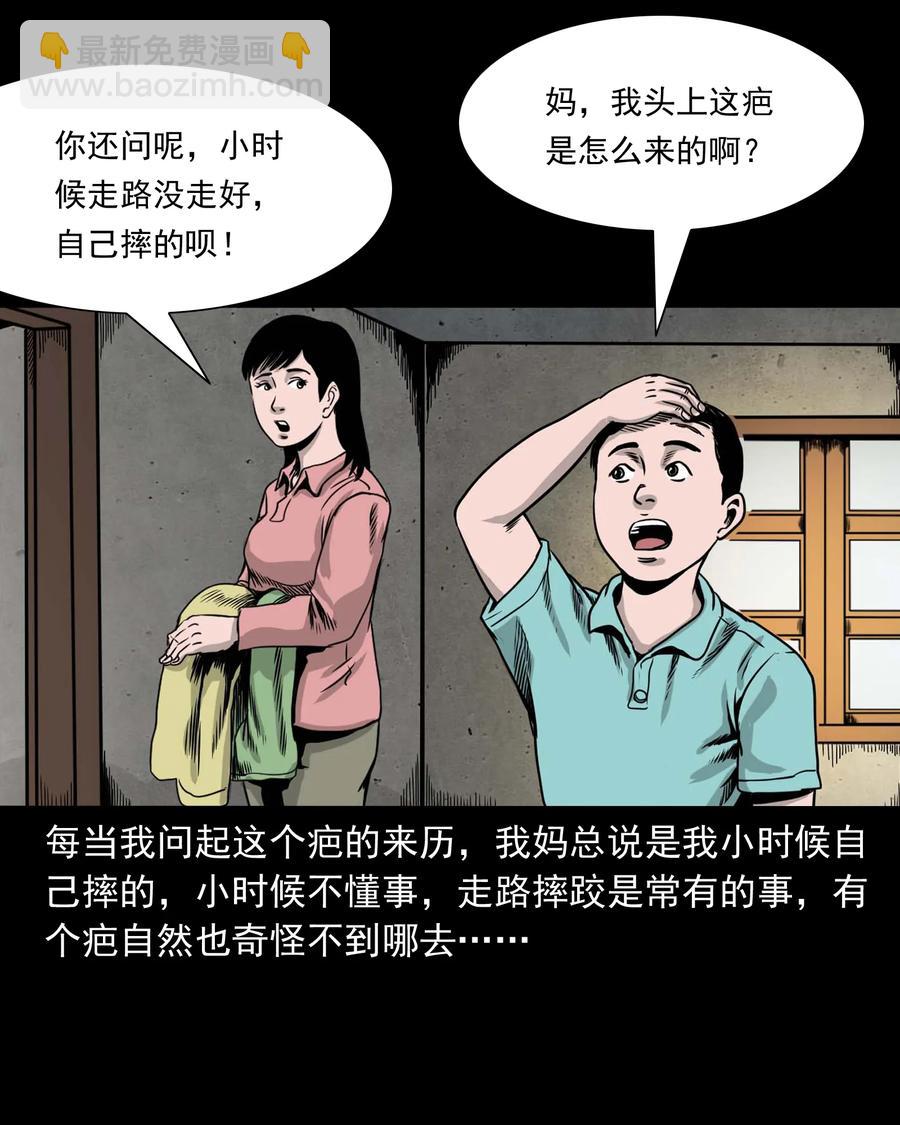 335 额头上的疤(1/2)-第337话