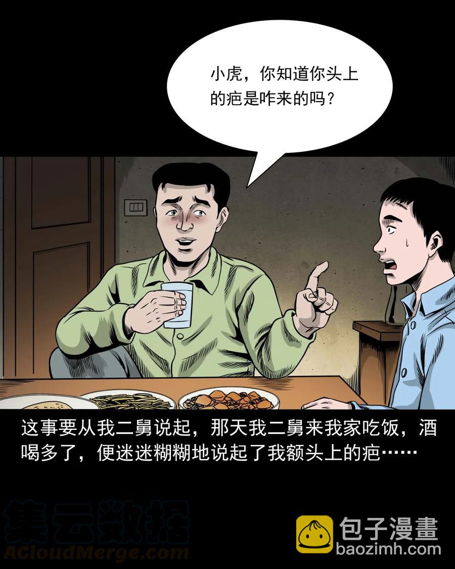 335 额头上的疤(1/2)-第337话