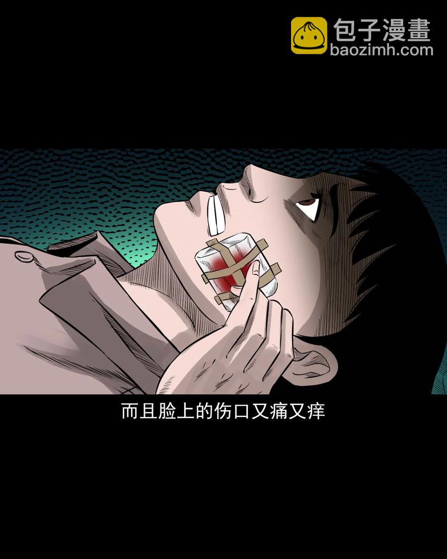 533 下毒咒(1/2)-第535话