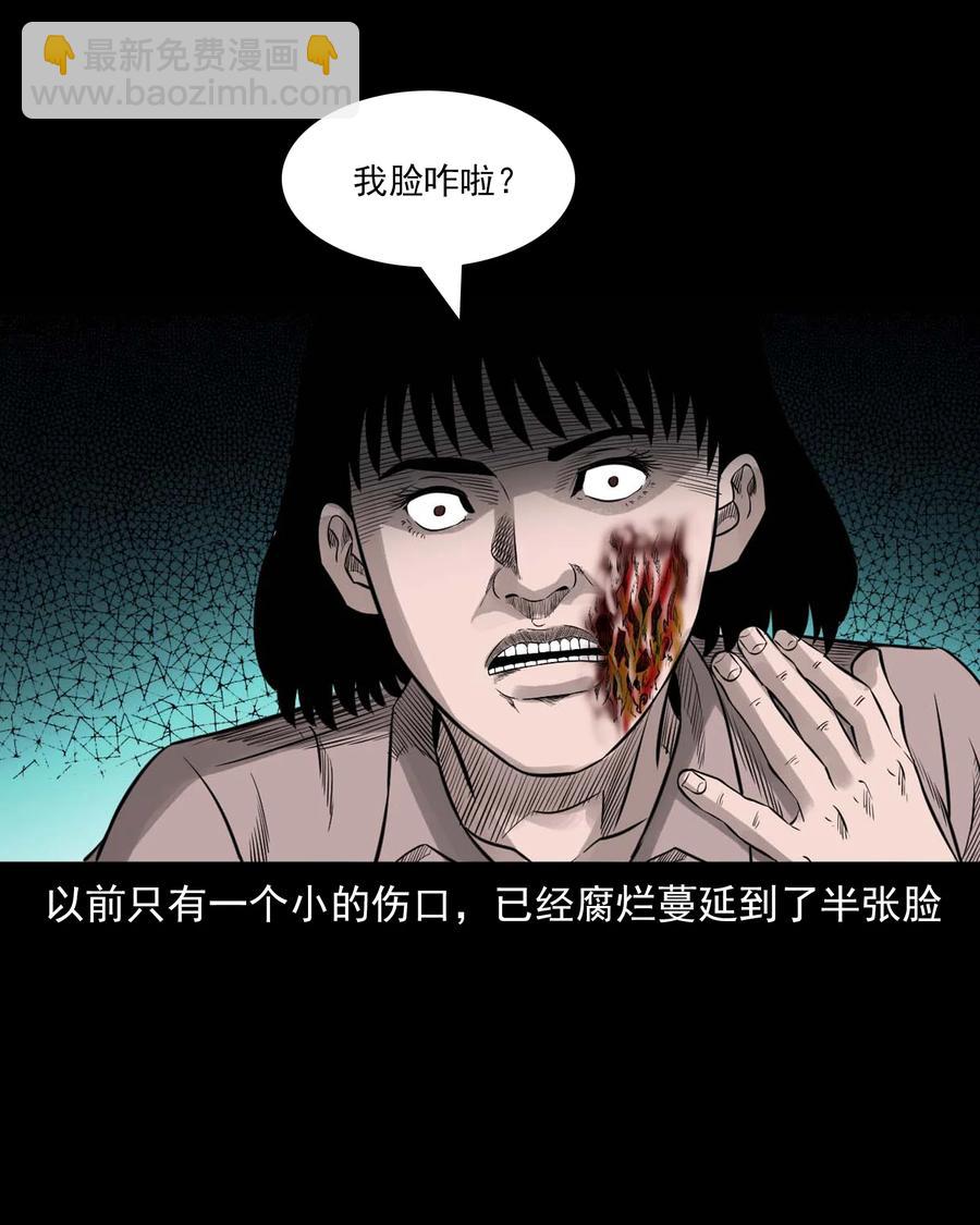 533 下毒咒(1/2)-第535话