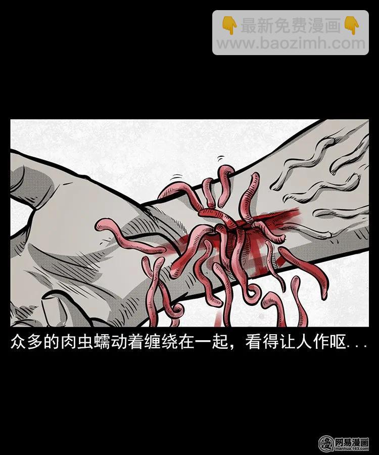 67 赤脚医生破蛊（下）(1/2)-第67话
