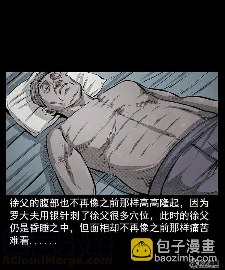 67 赤脚医生破蛊（下）(1/2)-第67话