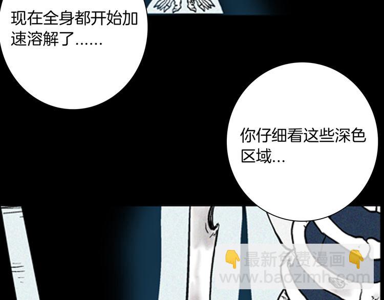 第63话 骨头溶解症（上）(1/3)-第63话