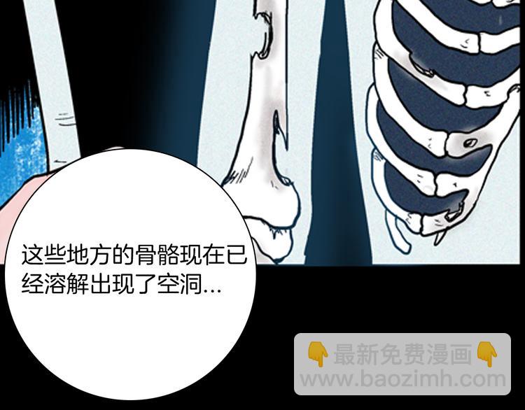 第63话 骨头溶解症（上）(1/3)-第63话