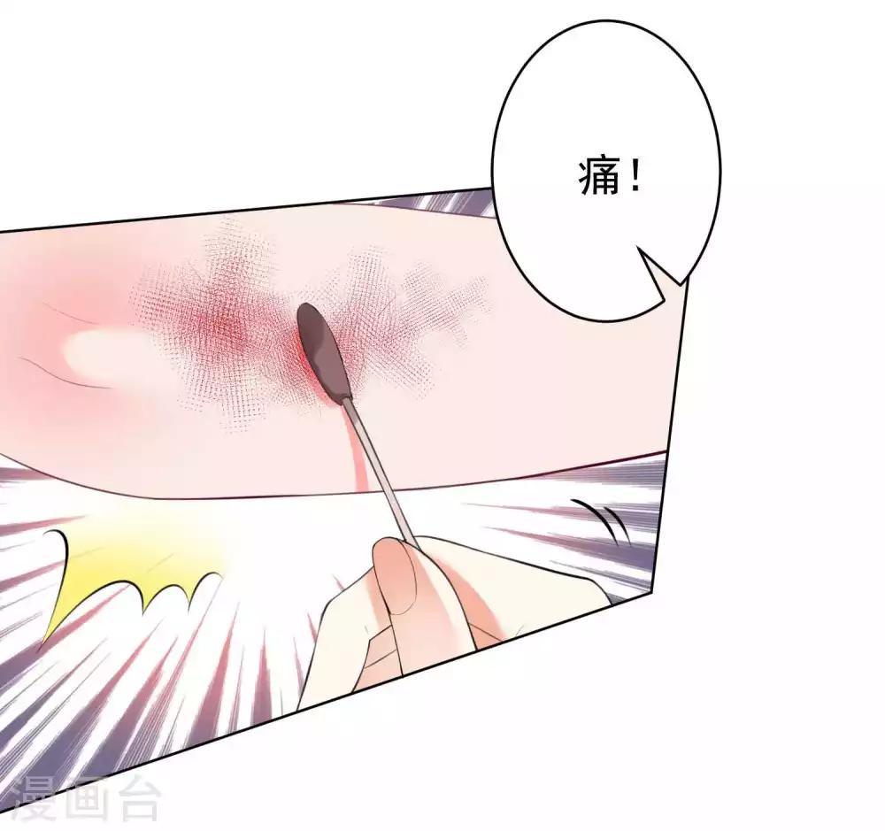 第87话-第93话