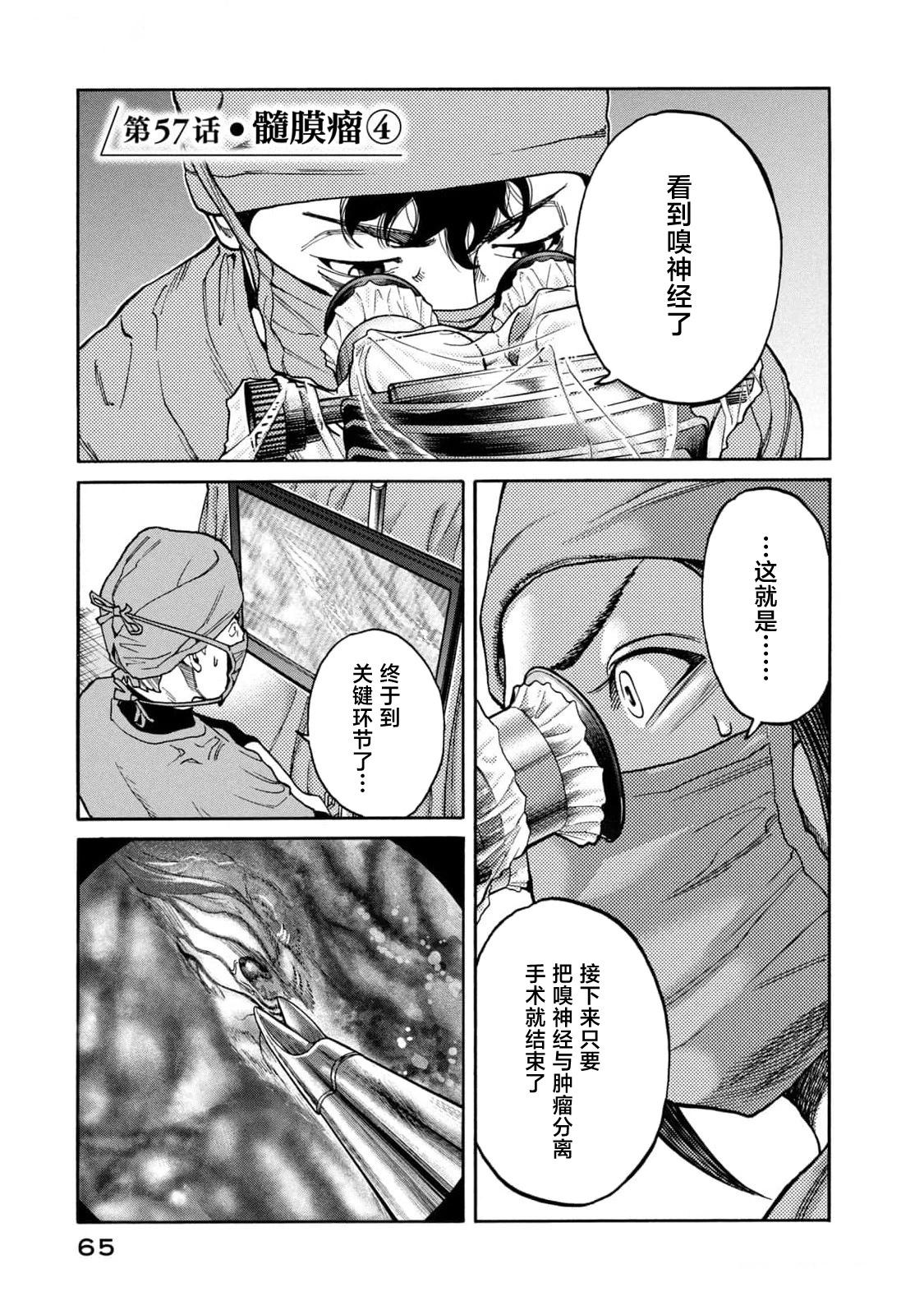 Unmet－某脑外科医的日记－ 第57话