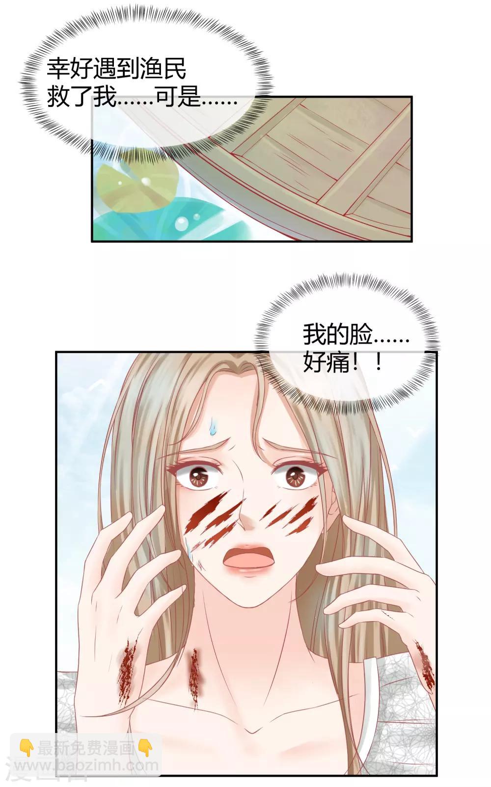 第1话 是谁要害我毁容？-第1话