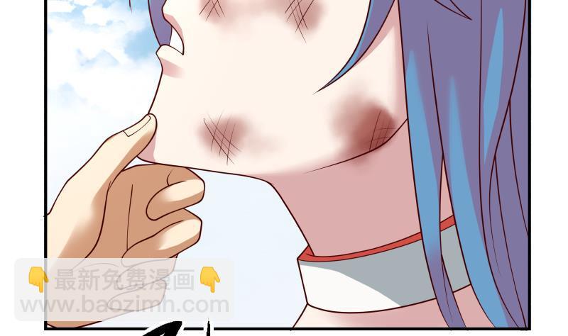 第340话 毁容-第339话