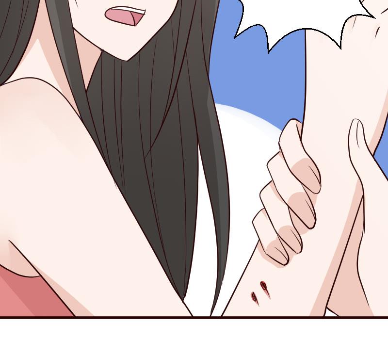 第101话 她受伤了-第101话